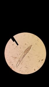 ニキビに最適な皮膚科はどこ？比較してわかる選び方は？